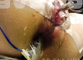 Close-up: Inserting a thick metal hindrance into the urethra... Pissing and squirting! (For full video, please visit "Website".)
