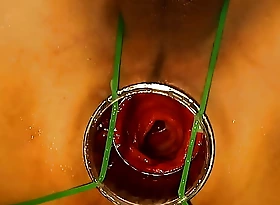 尻穴拡張家 アナルくぱぁではなく、結腸くぱぁ。結腸飛び出しながらディルド排出して、ぼっかり結腸にザーメンローションの糸引いてるの二次元エロ絵と完全に一致。Colon rose become
